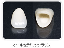 オールセラミッククラウン