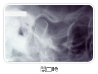 閉口時